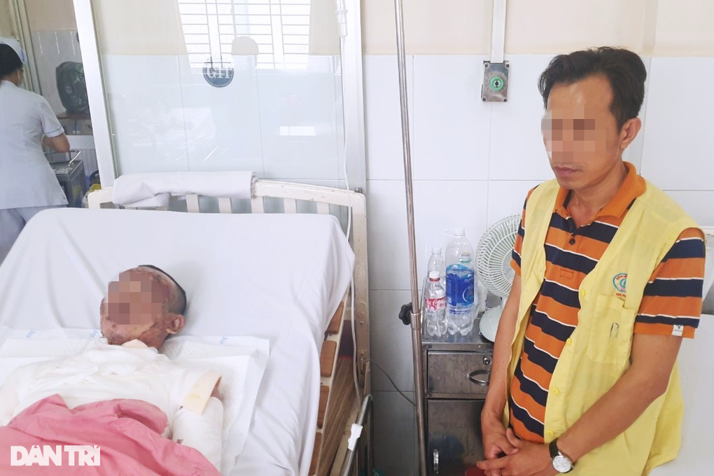 TPHCM: Một tháng có hàng chục ca bỏng nát cơ thể vì dùng cồn nướng mực - 2 TPHCM: Một tháng có hàng chục ca bỏng nát cơ thể vì dùng cồn nướng mực - 2