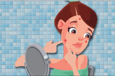 Tại sao bạn không nên nặn mụn?