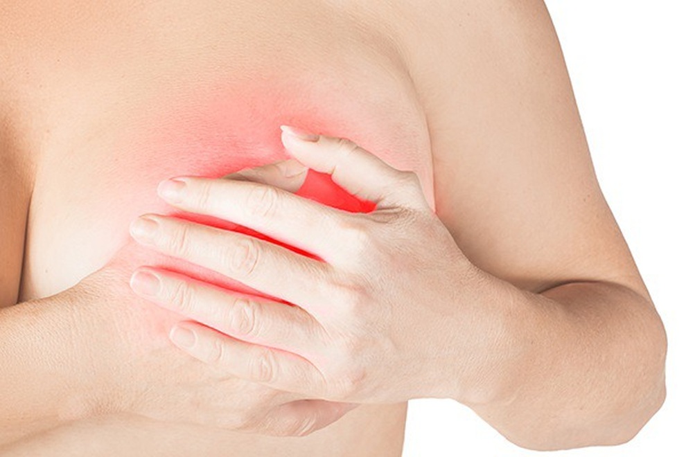 Vú chảy dịch bất thường, có phải ung thư? - 1 Vú chảy dịch bất thường, có phải ung thư? - 1