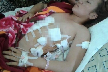 Vợ trẻ nghi bị tình nhân của chồng đâm nhiều nhát vào người