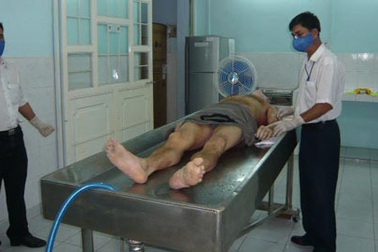 Nỗi ám ảnh của những người chuyên mổ tử thi