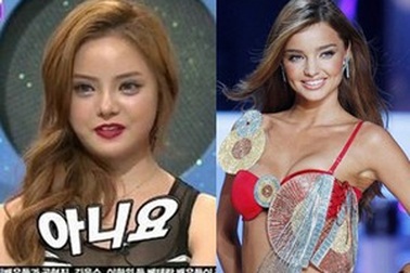 Phẫu thuật thẩm mỹ để giống hệt thần tượng siêu mẫu