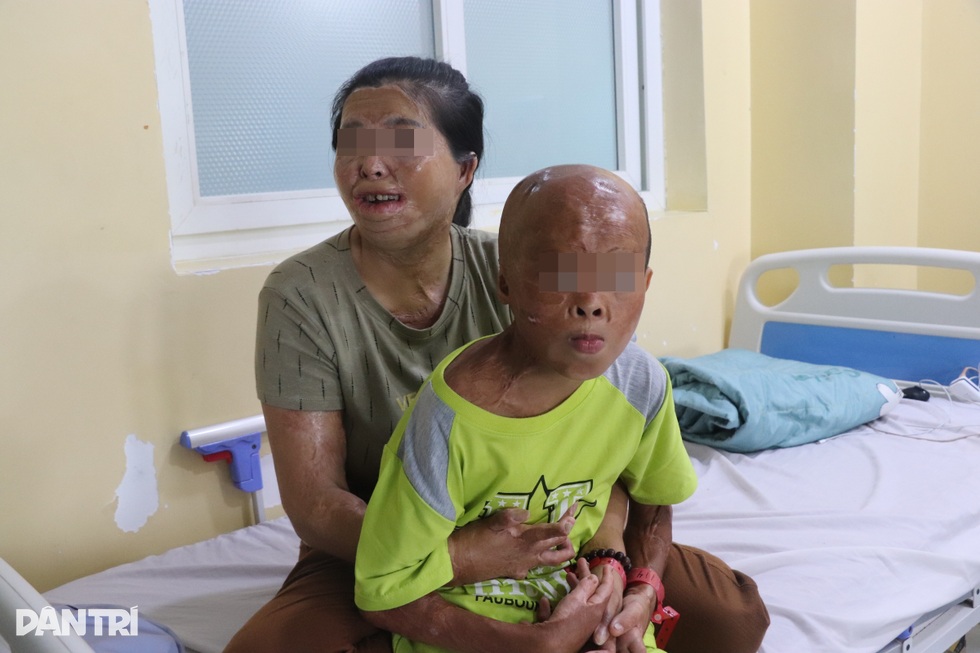 Những ca mổ “0 đồng” giúp hàng trăm người tìm lại hình hài sau biến cố - 1