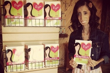 Cuốn sách về cuộc đời cô gái gầy nhất thế giới đắt khách