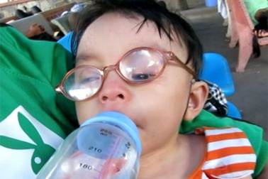 Bé gái chưa đầy 2 tuổi đã bị mờ mắt và tim bẩm sinh