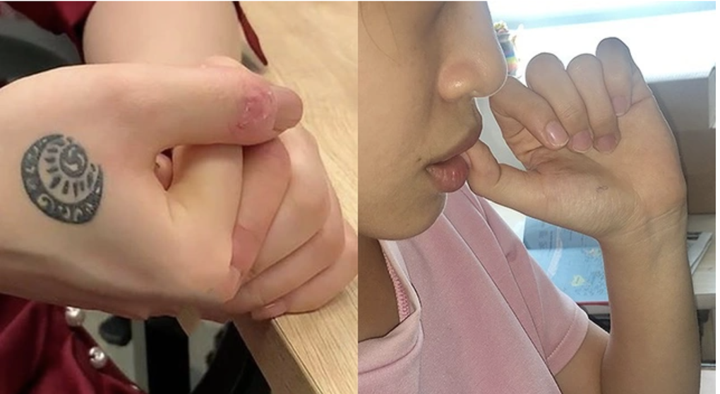 Bố mẹ tá hỏa vì con học giỏi nhưng mắc chứng tự hủy hoại bản thân - 7 Bố mẹ tá hỏa vì con học giỏi nhưng mắc chứng tự hủy hoại bản thân - 7