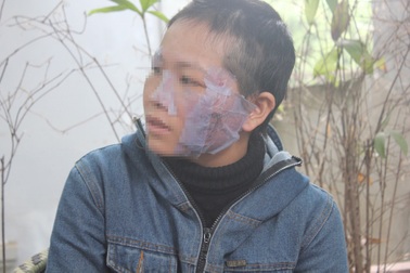 Chồng dí bát sắt nung đỏ vào mặt vợ vì "tội" tham gia đa cấp?