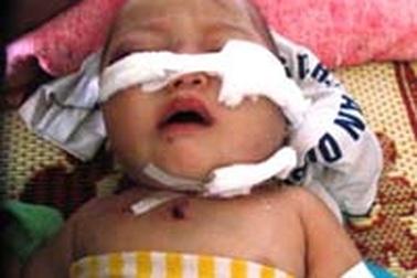 Trâu bò “choảng” nhau, hai chị em ruột nguy kịch