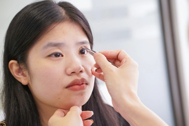 Mí mắt phẫu thuật thẩm mỹ bị lỗi có sửa được không?