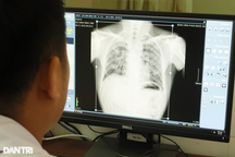 Thông tin mới vụ 6 công nhân tử vong do bụi phổi