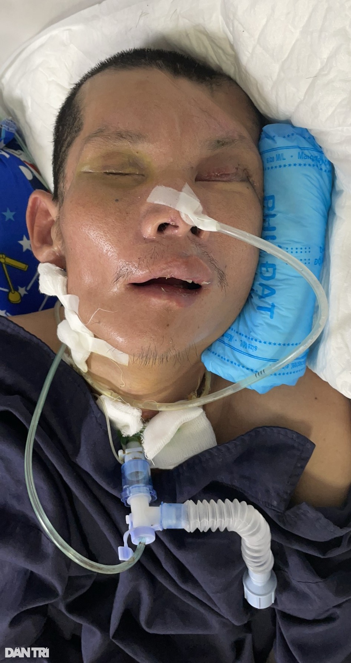 Bác sĩ BV Thanh Nhàn cầu cứu giúp bệnh nhân vô danh bị tai nạn nguy kịch - 3 Bác sĩ BV Thanh Nhàn cầu cứu giúp bệnh nhân vô danh bị tai nạn nguy kịch - 3