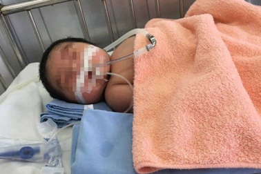 Trẻ 2 tháng tuổi tử vong sau tiêm vắc xin 5 trong 1