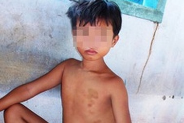 Bị cha đánh dã man trong ngày Thiếu nhi