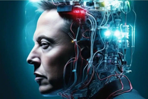 Người đầu tiên cấy chip vào não đã có thể chơi game trên laptop bằng ý nghĩ