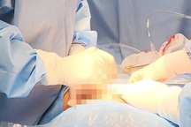 Vụ "bệnh nhân đau ruột thừa bị cắt buồng trứng": Rất dễ chẩn đoán nhầm