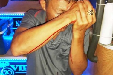 Nghi án nổ súng giữa 2 nhà xe do tranh giành khách