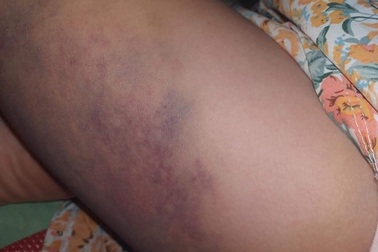 Phụ huynh tha lỗi cho cô giáo đánh học sinh nhưng xin được đổi chủ nhiệm