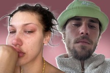 Sự thật đằng sau ảnh giàn giụa nước mắt của Justin Bieber