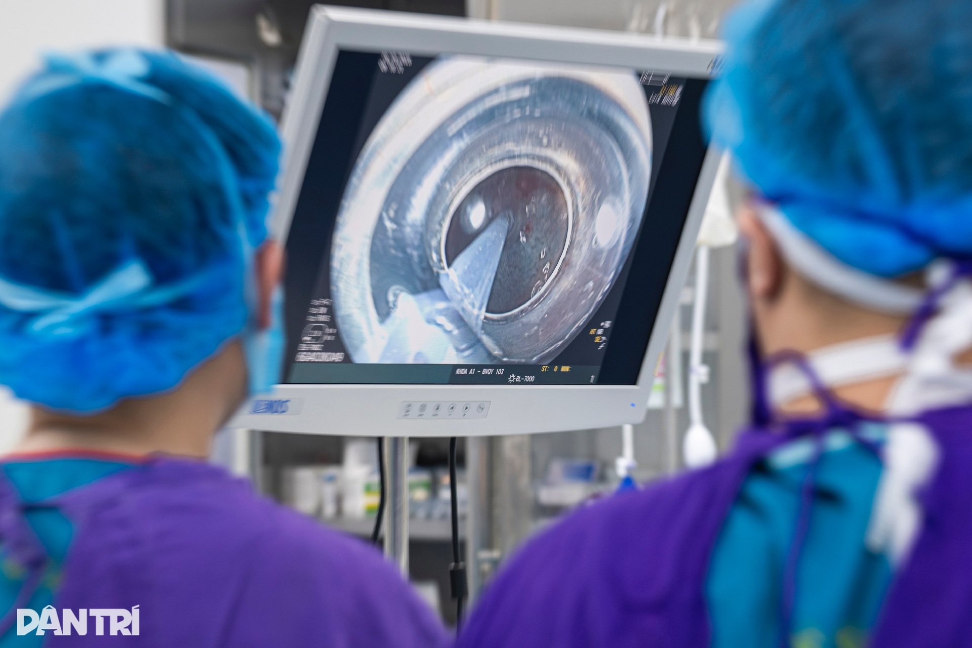 Xem bác sĩ thâm nhập dạ dày truy vết ung thư - 6 Xem bác sĩ thâm nhập dạ dày truy vết ung thư - 6