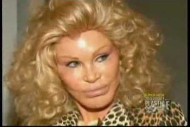 Jocelyn Wildenstein sửa mặt nhiều thế nào