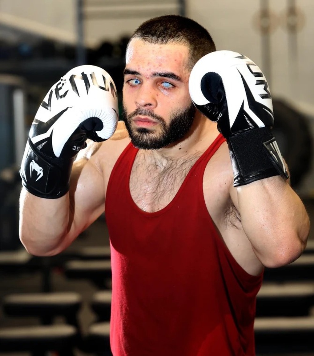 Chuyện lạ boxing: Võ sĩ mù cả hai mắt thách đấu đối thủ - 1