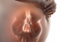 Hà Nội: Cặp song thai cùng trứng khác giới tính đầu tiên tại Việt Nam